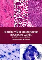 Plaučių vėžio diagnostikos ir gydymo gairės (3-as leidimas)