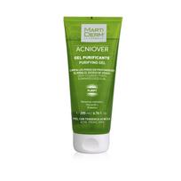 MARTIDERM VALOMASIS GELIS Į AKNĘ LINKUSIAI ODAI ACNIOVER, 200 ML