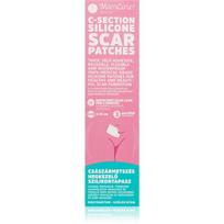 MomCare by Lina C-Section Silicone Scar Patches silikoniniai pleistrai randams po cezario pjūvio dydis S-M 3x15 cm 3 vnt.