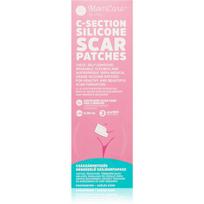 MomCare by Lina C-Section Silicone Scar Patches silikoniniai pleistrai randams po cezario pjūvio dydis L-XL 5 x 20 cm 3 vnt.