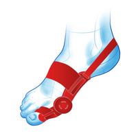 Koreguojantis kojos nykščio įtvaras Mazbit Hallux Remedium