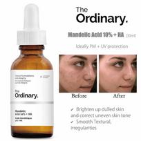 THE ORDINARY Migdolų rūgštis 10%+HA 30ml AUTENTIŠKA PARDUOTUVĖ