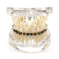 1 vnt. Dantų ortodontinis modelis, skirtas bendravimui su pacientu, 2 rūšių breketai su lankais ir ligatūromis, keraminiai breketai, metaliniai Edgewise breketai 1 piece Clear gryna