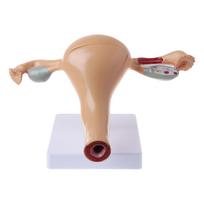 Žmogaus patologinis gimdos kiaušidžių modelis Anatominis Anatomija Liga Patologija Medicininė pažeida Mokymas beige