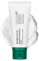 HOLIKA HOLIKA Acnenator  valomosios putos, 150 ml