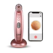 GESS SLEEK – inkštirų šalinimo vakuuminis prietaisas su kamera