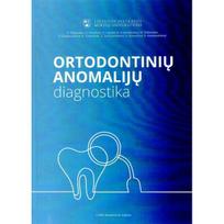 Ortodontinių anomalijų diagnos tika