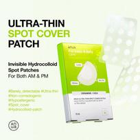 Anua UltraThin Spot Cover Patch 75ea +RANDOM GIFT