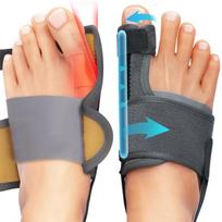 Hallux valgus korektorius vyrams ir moterims, kojų pirštų valgus separatorius, pirštų atskyrimo korekcija, aliuminio juostelės atrama