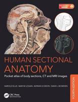 Human Sectional Anatomy: Pocket atlas of body sections, CT and MRI images, Fourth edition