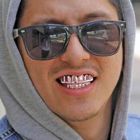 PARDUOTUVĖS ISTORIJA - Hiphopo stiliaus „Grillz“ dantų rinkinys - rožinio aukso spalvos