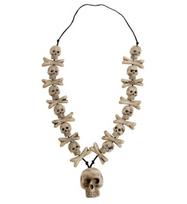 Vėrinys (skeletas)