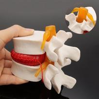 Žmogaus anatomija Skeletas Stuburas Juosmens disko išvarža Mokomasis modelis Smegenys Kaukolė Trauminis Pistoletas Mokyklinės prekės Medicininis instrumentas a kit