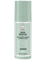 GMT Beauty veido serumas nuo spuogų Gmt Skin Rescue Anti-acne 30ml