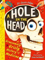 Hole in the Head, A gruesomely grisly history of medical firsts