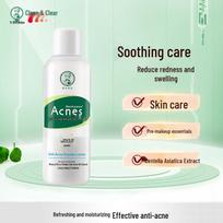 Mentholatum Acnes Tonikas nuo spuogų