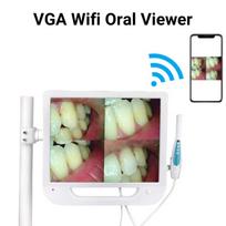 Dantų HD intraoralinė kamera WIFI CMOS LED intraoralinio tyrimo kamera su 17 colių monitoriaus ekranu EU Plug balta