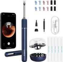 Otoscope with ear cleaning camera Bebird Note 5 pro (white) | Bebird Note5 pro | 6972403826454