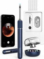 Otoscope with ear cleaning camera Bebird Note 5 pro (blue) | Note5pro | 6972403826430