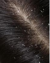 NURME - Hair Care dovanų rinkinys For Irritated Scalp