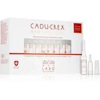 Gydymas vyrams, kuriems prasideda plaukų slinkimas Plaukų slinkimas HSSC 20 x 3,5 ml