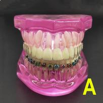 Dantų dantų modelis Ortodontinis modelis, skirtas pacientų bendravimui Dantų tyrimo dantų modelis su nematomu permatomu kronšteinu Odontologų modeliai 1 piece A pink rožinė