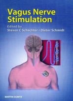 Vagus Nerve Stimulation