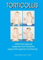 Torticollis