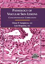 Pathology of Vascular Skin Lesions