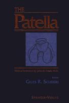 Patella