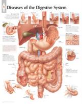 Diseases of the Digestive System Paper Poster