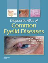 Diagnostic Atlas of Common Eyelid Diseases