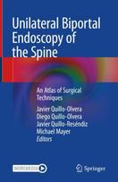 Unilateral Biportal Endoscopy of the Spine
