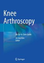 Knee Arthroscopy