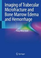 Imaging of Trabecular Microfracture and Bone Marrow Edema and Hemorrhage