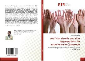 Artificial dermis and skin regeneration: An experience in Cameroon: Reconstructing extensor tendon mobility planes of the hand