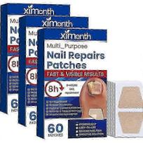 Toenail Fungus Treatment Stickers Ingrowning Toenail Nail Repair Patch 60pcs/box
