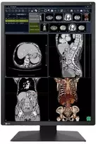 Monitorius EIZO RadiForce RX270, 54.1 cm (21.3"), 1200 x 1600 pikselių, UXGA, LCD, 20 ms, Juodas, Baltas