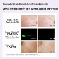 UNES Targeted Freeze-Dried Skincare Essence Series