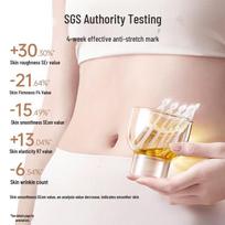 Kangaroo Mommy Pregnancy Olive Oil for Stretch Marks