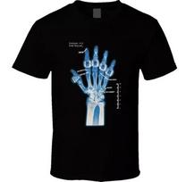 Kobe Bryant Hand X Ray Rings Champion Basketball Fan T Shirt L