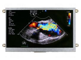 Display: TFT | 7" | 800x480 | Illumin: LED | Dim: 180.1x104x16.6mm | RGB