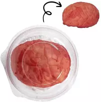 Kraujuotos smegenys