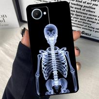 Radiological Human Organs Skeleton For Realme C63 C71 C55 C67 C51 C75 C61 C65 C53 10 11 12 13 14 15 Pro Plus GT6 GT7 Pro Case For Realme GT6