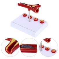 Pvc Cardiovascular Model Science Atherosclerosis Display Hospital Teaching Supplies Anatomical Models Physiology