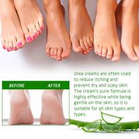 Urea Hand And Foot Cream Softens And Moisturizes Skin Relieves Dryness Repairs Cracks Exfoliates Dead Skin Care New one size