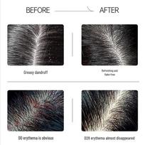 Spes Red Myrrh Peptide Anti-Dandruff Itch Relief Shampoo