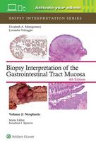 Biopsy Interpretation of the Gastrointestinal Tract Mucosa Volume 2: Neoplastic: Print + eBook with Multimedia