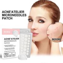 OUHOE acne patch, repairs acne and blackheads, facial redness, cleanses pores and moisturizes skin patch