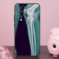 X-Ray Human Anatomy Funda For Honor Magic 6 Pro 5 Lite 10 50 70 90 Honor X8a X9a X8b X9b X7 X8 X9 X6a X7a Case Honor X9a